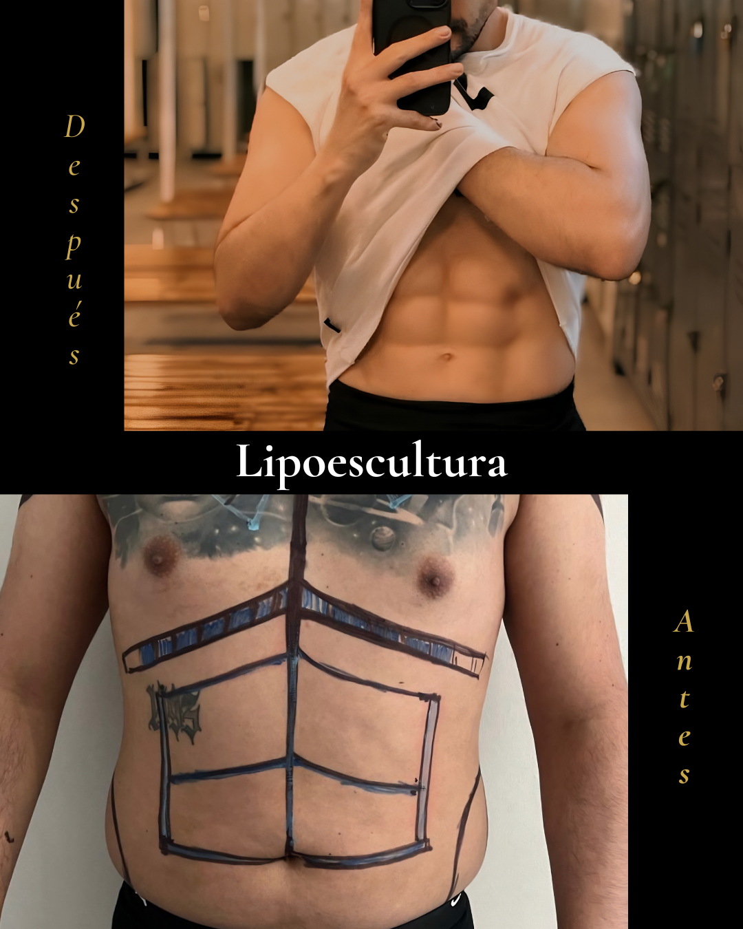 Resultado antes y después · caso 3